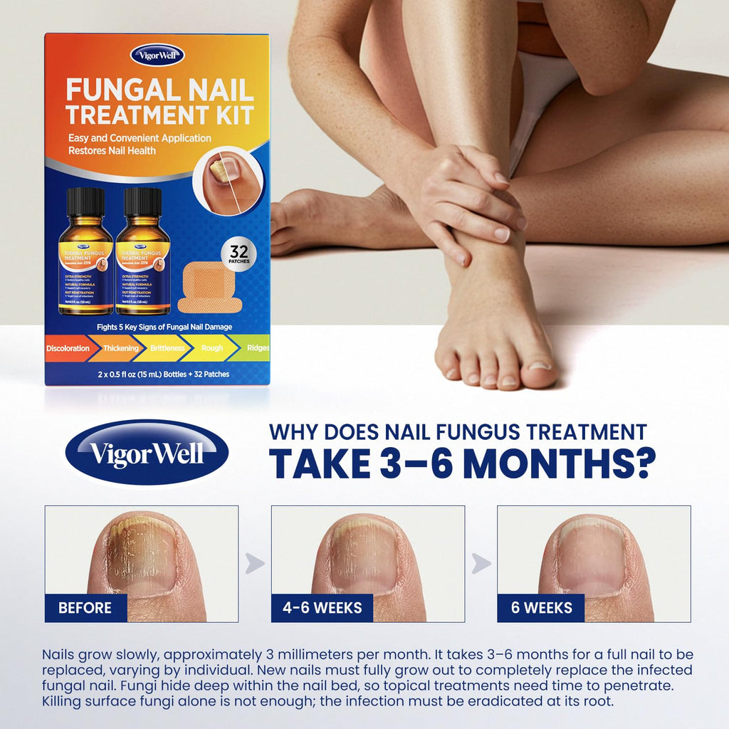 VigorWell Toenail Treatment Extra Strength – Dual Action Nail Repair Kit (30 ml Gel + 32 Patches)