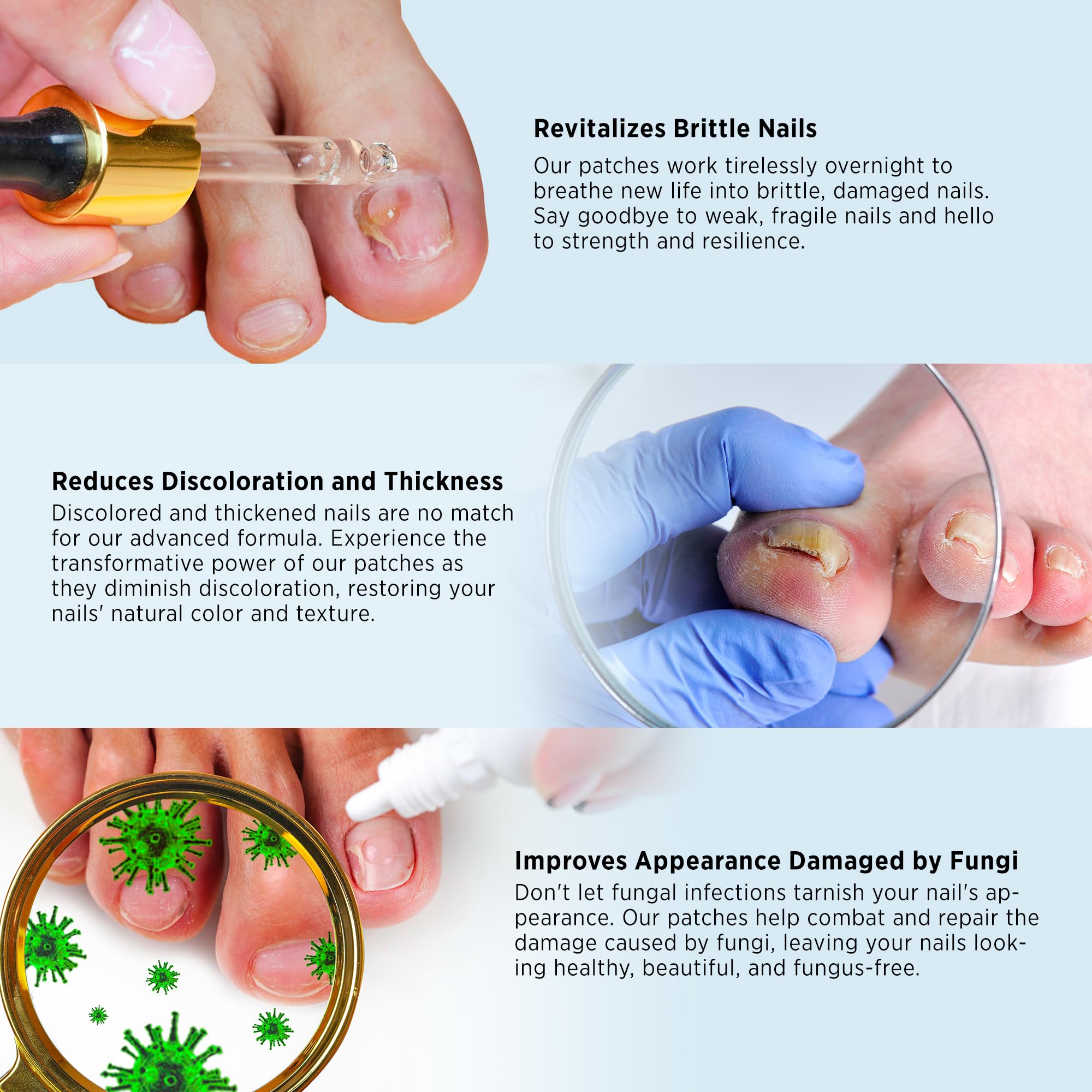 VigorWell Toenail Fungus Treatment Extra Strength – Nighttime Patches & 15ml Nail Repair Liquid (32 Patches)
