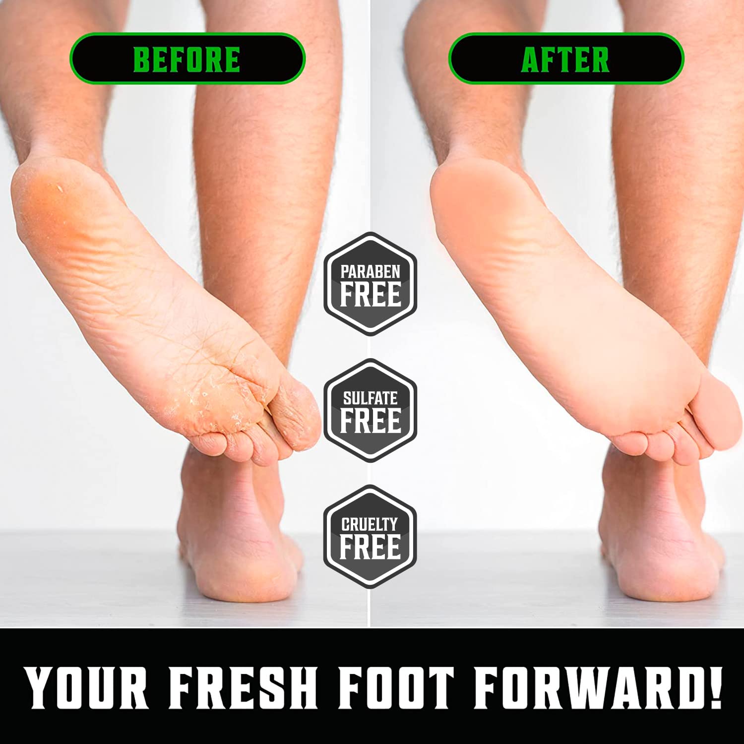 Viking Revolution Tea Tree Foot Cream for Dry Cracked Heels – 8oz Pack of 2