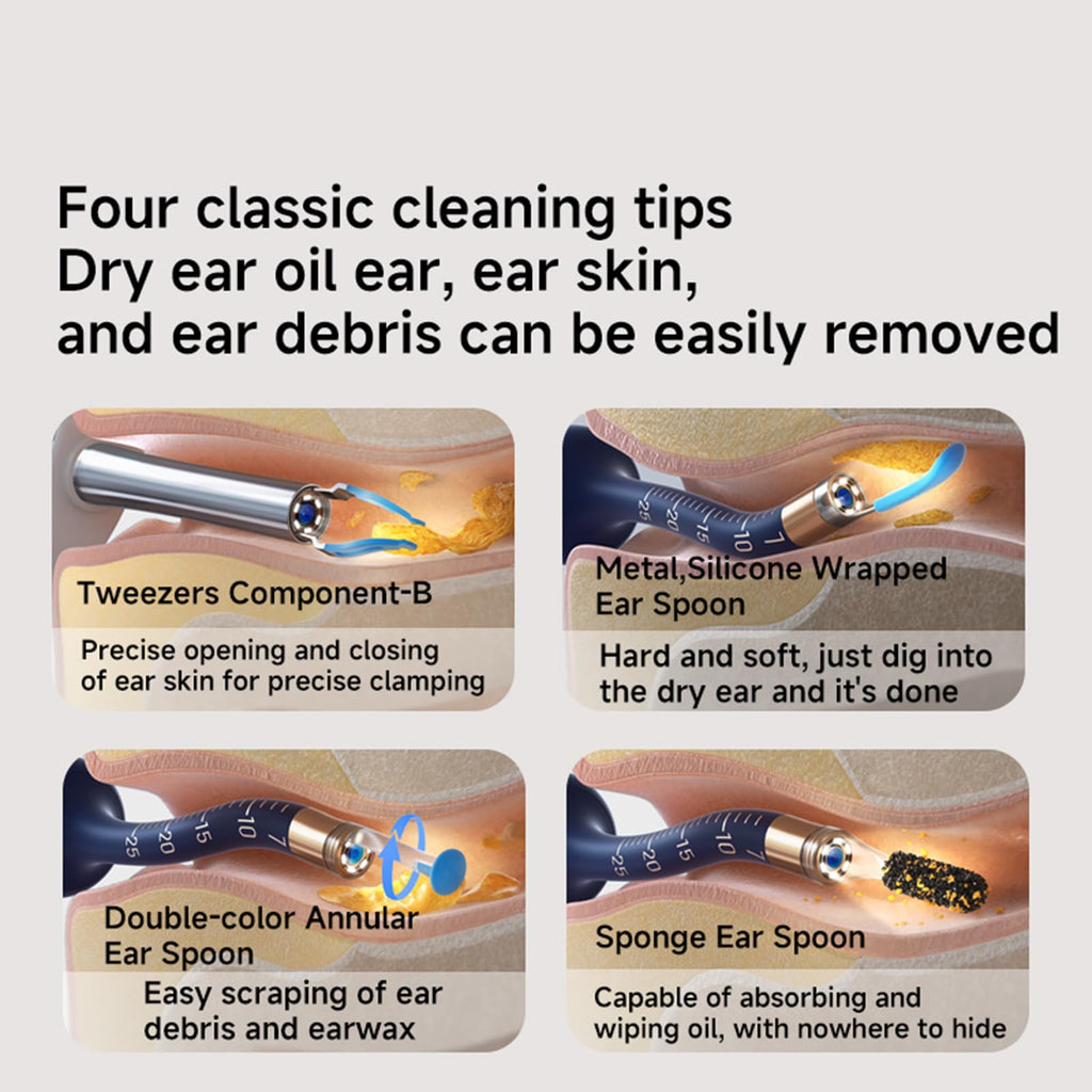 VILLA ART Earsight Plus E33R Ear Wax Removal Tool Camera — Family Otoscope Kit