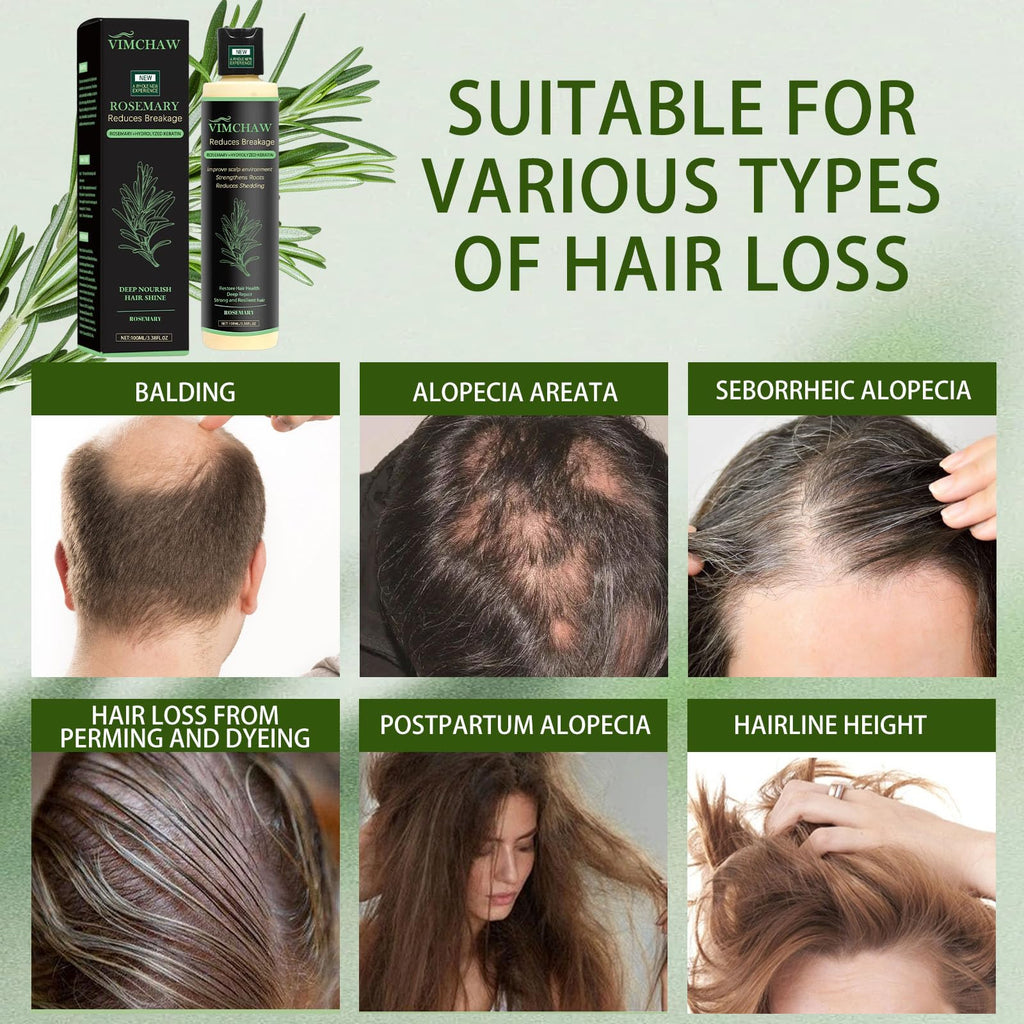 Vimchaw Organic Rosemary Hair Growth Shampoo for Thinning Hair | Strengthening with Hydrolyzed Keratin