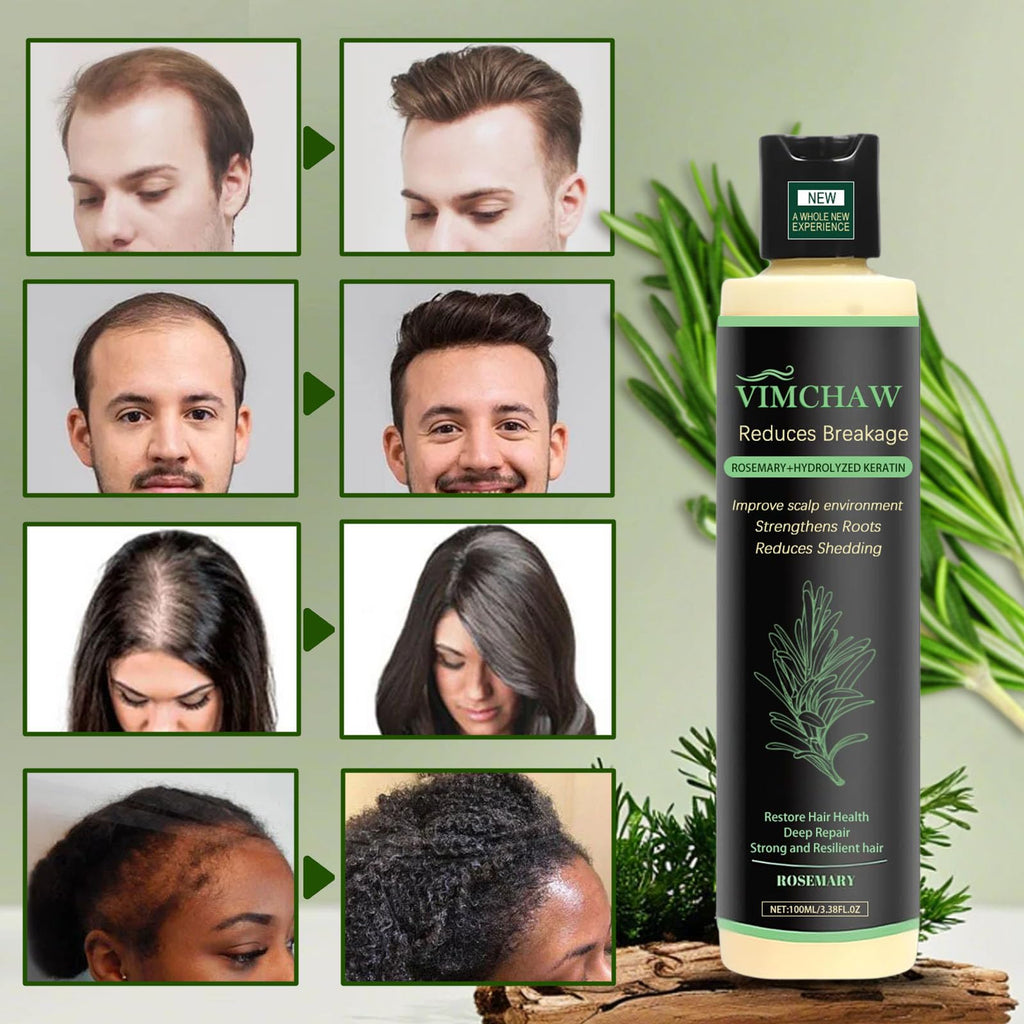 Vimchaw Organic Rosemary Hair Growth Shampoo for Thinning Hair | Strengthening with Hydrolyzed Keratin