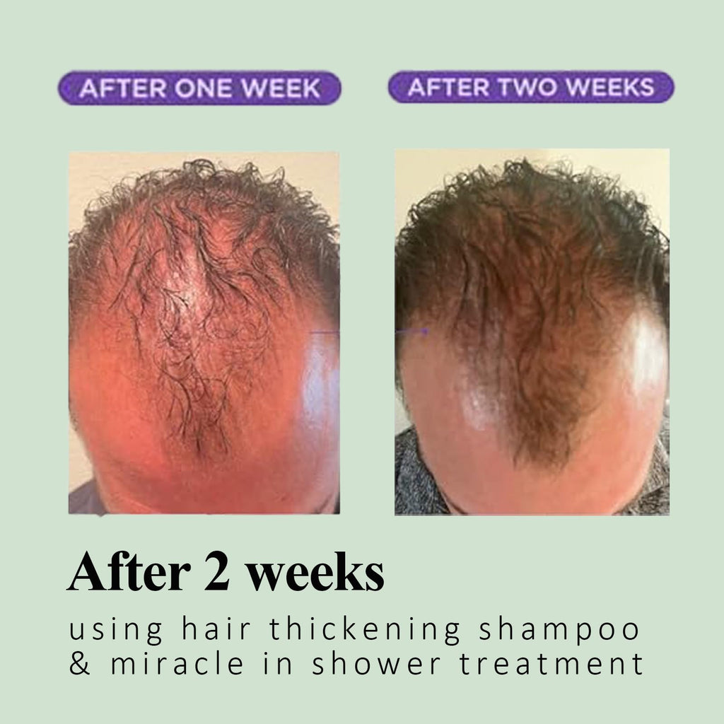 Vimchaw Rosemary Hair Growth Shampoo | Organic Thickening for Thinning Hair (3.4 fl oz)