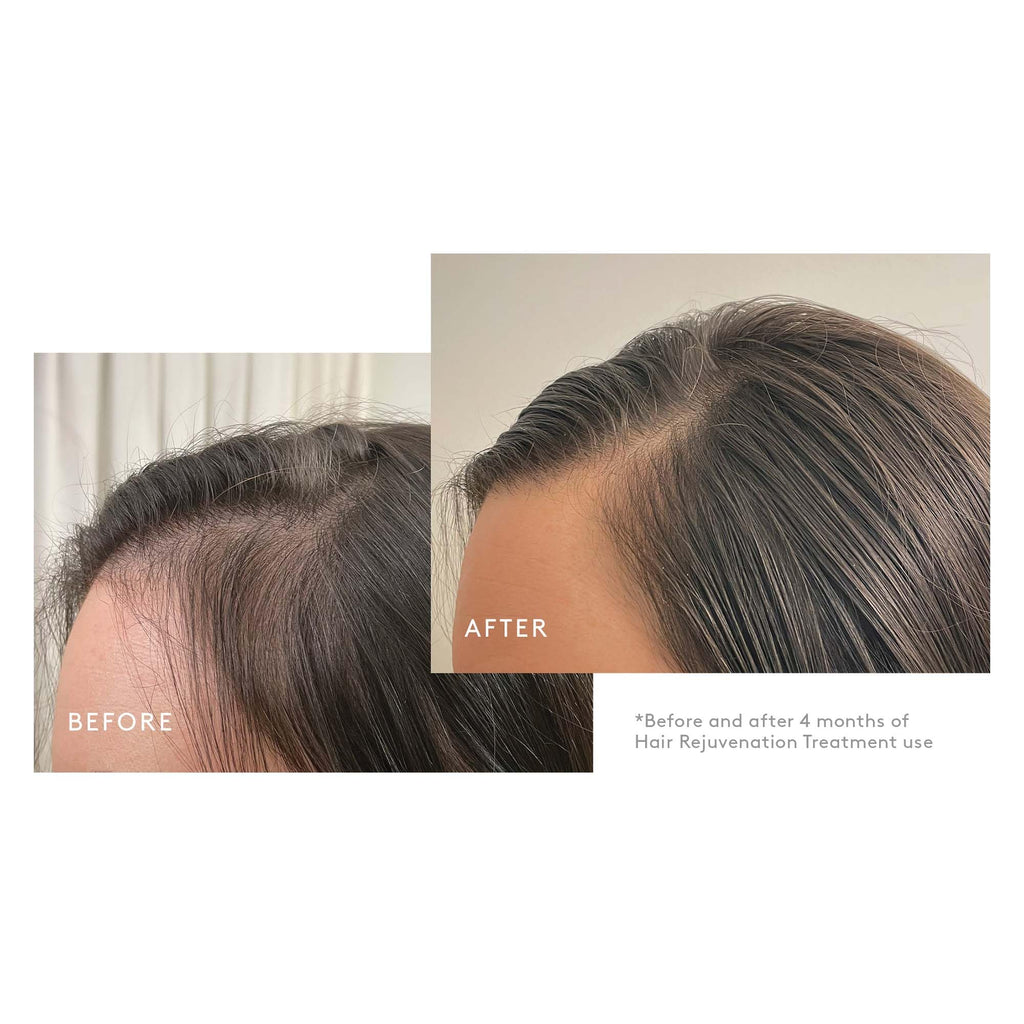 Virtue Flourish 3-Step Hair Care Bundle for Thinning Hair – Drug-Free Regimen
