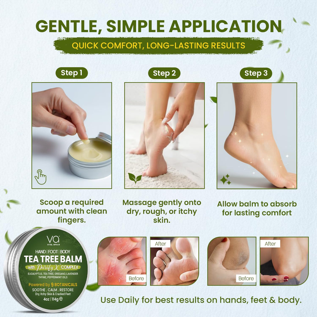 VITAL AFFAIR Tea Tree Oil Balm – Soothing Care for Dry, Sensitive Skin (4 oz)