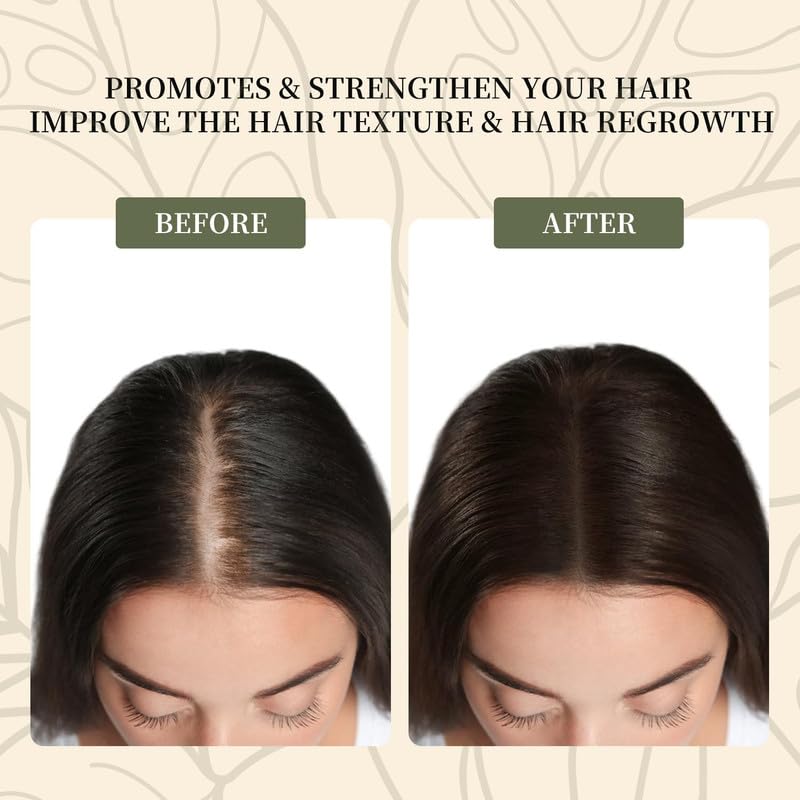 Vivccon Batana Oil for Hair Growth – 100 Percent Pure and Natural from Honduras