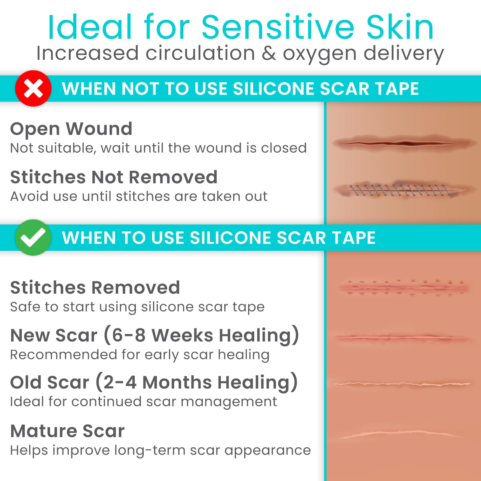 Vive Care Silicone Scar Sheets Tape – 1.6 inch x 120 inch Roll – Medical-Grade, Waterproof & Reusable