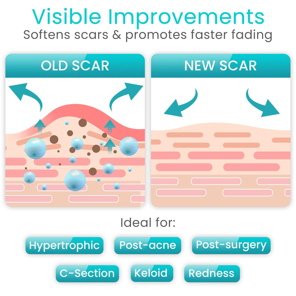 Vive Care Silicone Scar Sheets Tape – 1.6 inch x 120 inch Roll – Medical-Grade, Waterproof & Reusable
