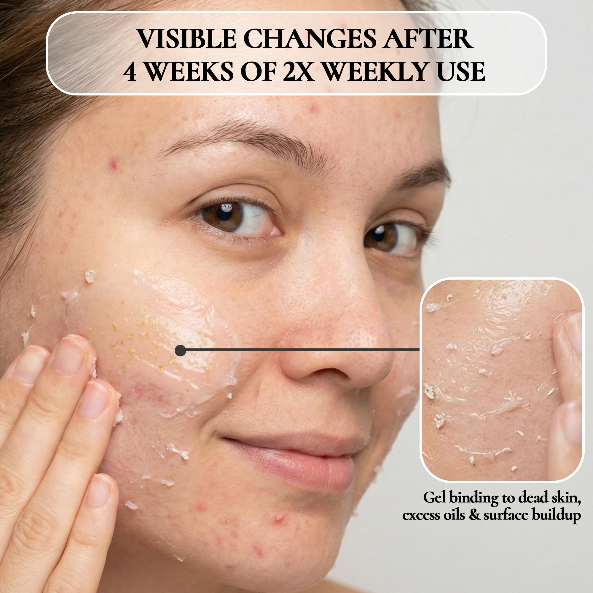 Vivo Per Lei Facial Peeling Gel – Gentle, Non-Abrasive Exfoliator for Sensitive, Dry & Mature Skin (4 x 4.05 oz)