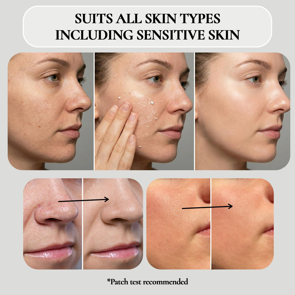 Vivo Per Lei Facial Peeling Gel – Gentle, Non-Abrasive Exfoliator for Sensitive, Dry & Mature Skin (4 x 4.05 oz)