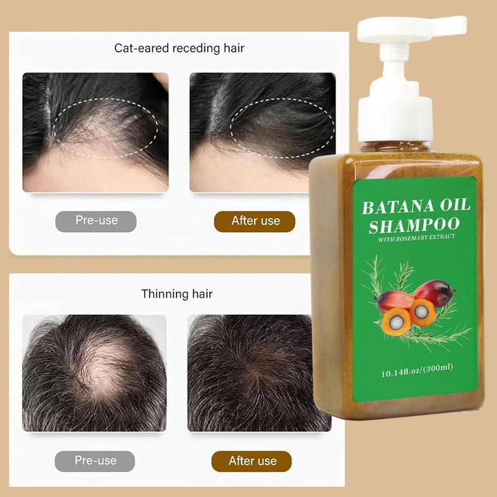 VJPPII Batana Oil Shampoo with Rosemary Extract – 300ml for Hair Growth & Hydration
