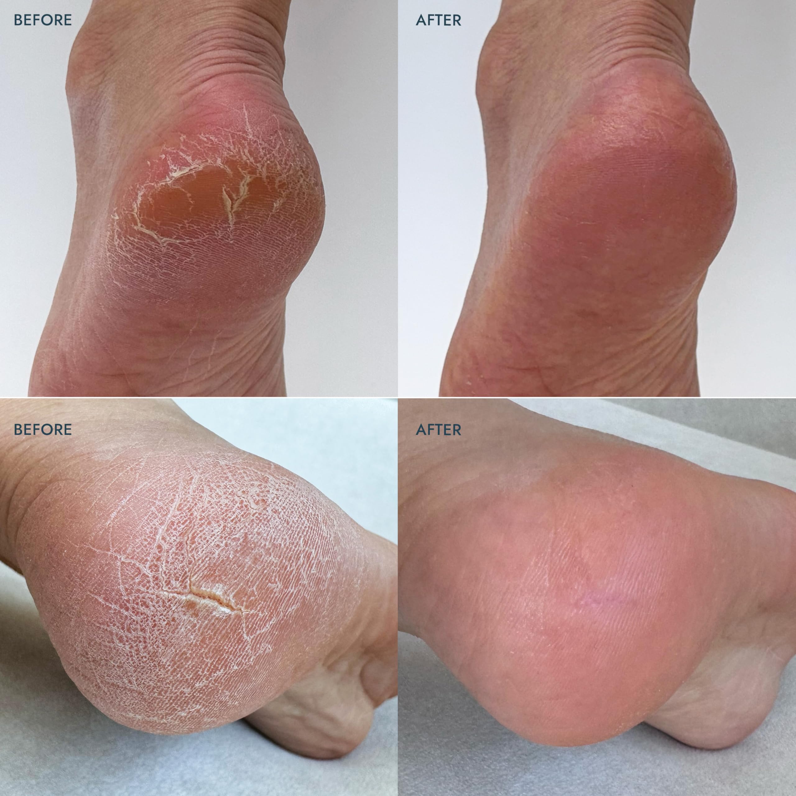 VOESH Solemate Heel Repair Balm – Lavender | Deep Moisturizing Foot Care for Rough Heels