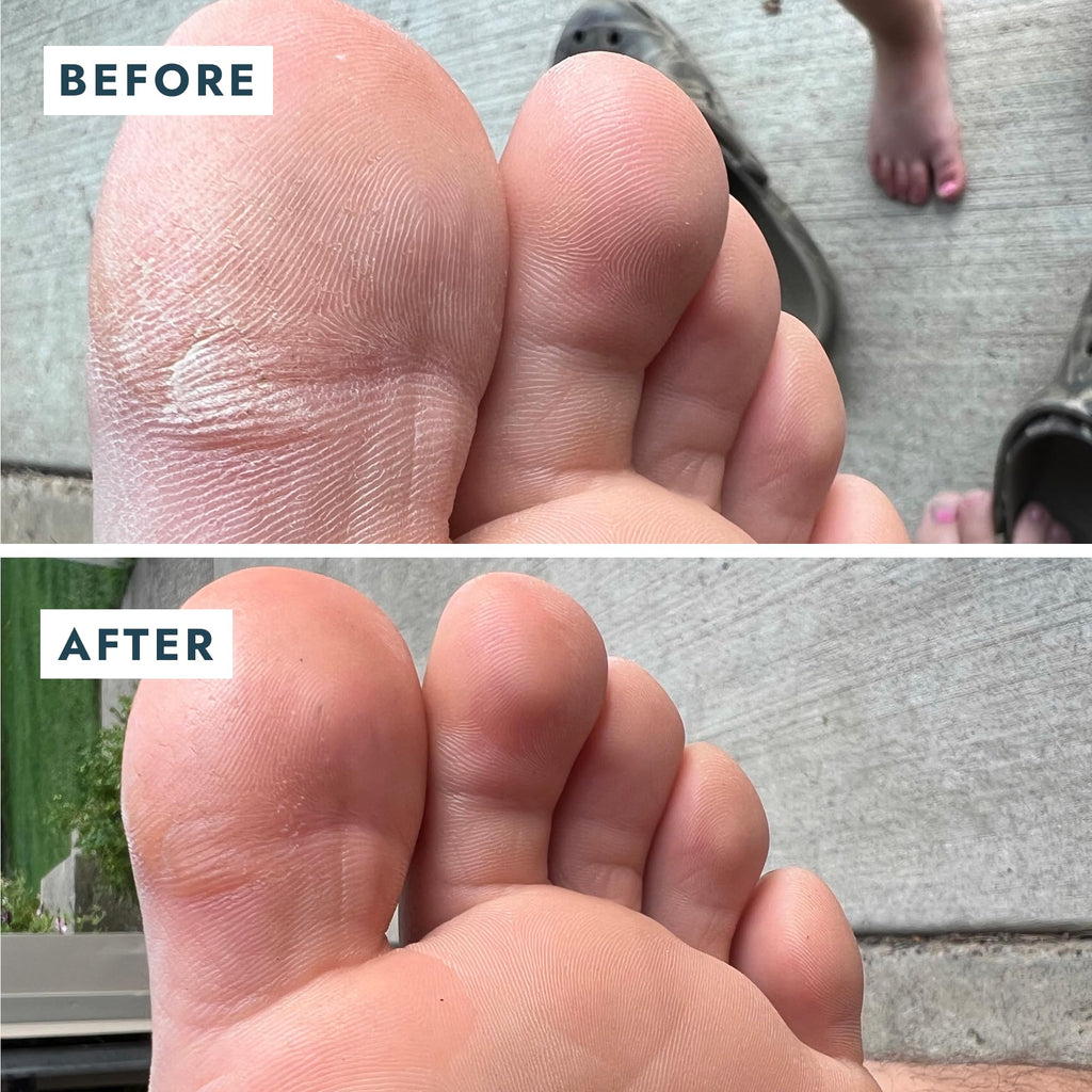 VOESH Solemate Heel Repair Balm – Deep Moisture for Rough Heels