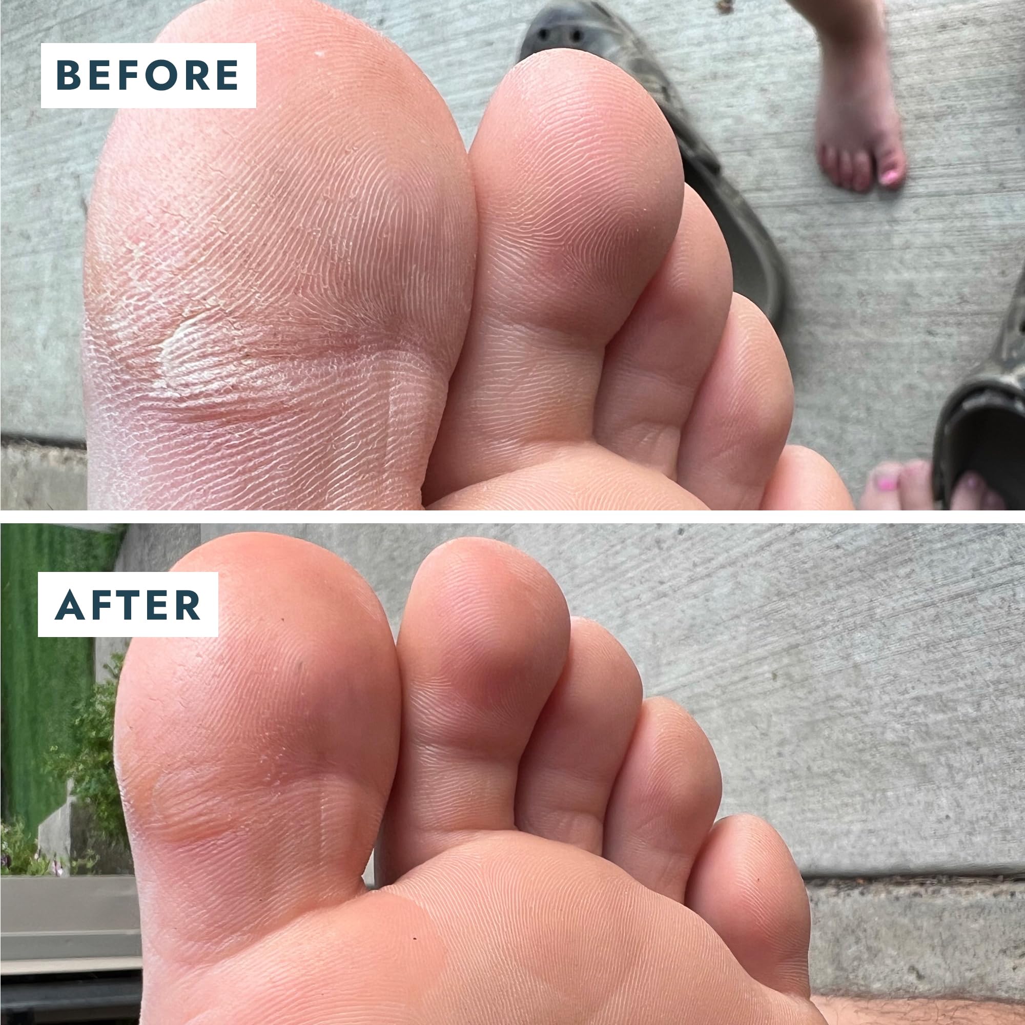 VOESH Solemate Heel Repair Balm – Deep Moisture for Rough Heels