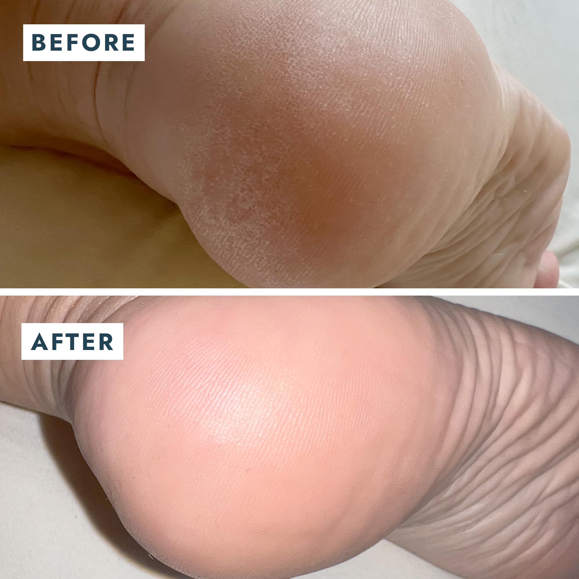 VOESH Solemate Heel Repair Balm – Deep Moisture for Rough Heels