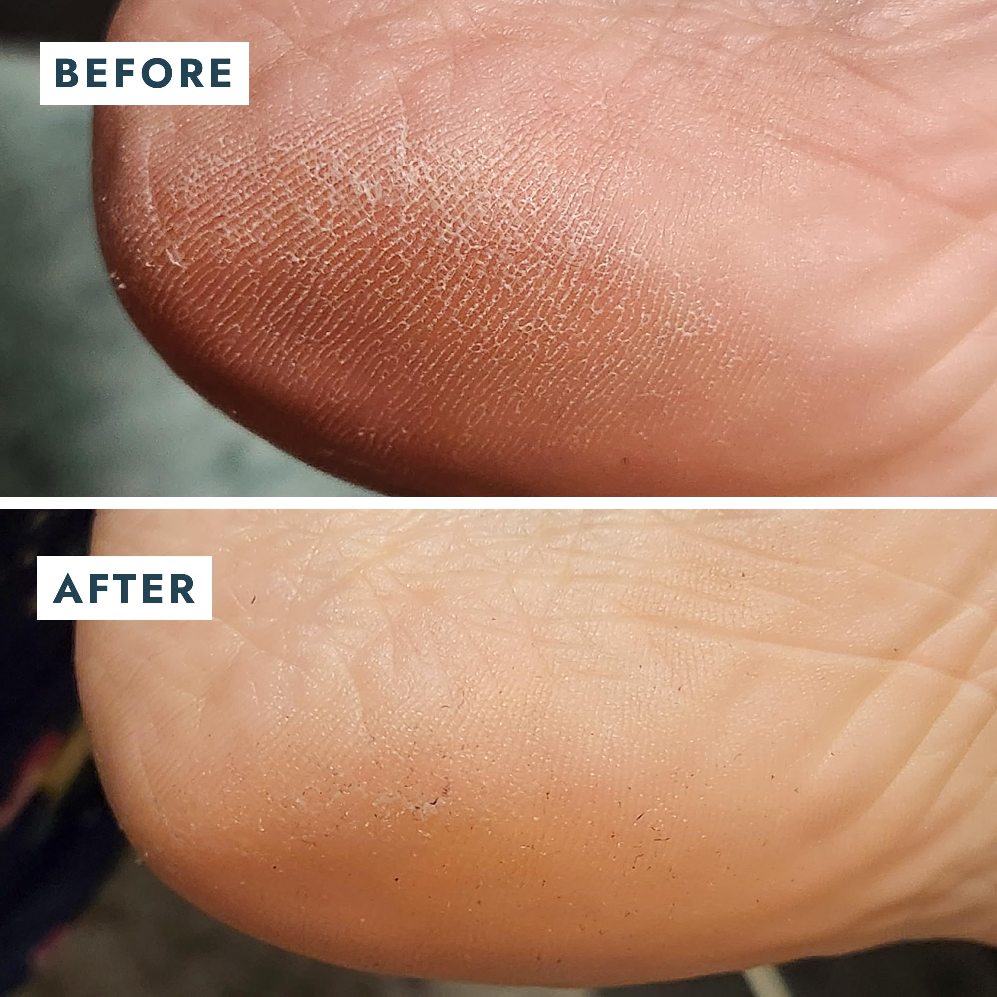 VOESH Solemate Heel Repair Balm – Deep Moisture for Rough Heels