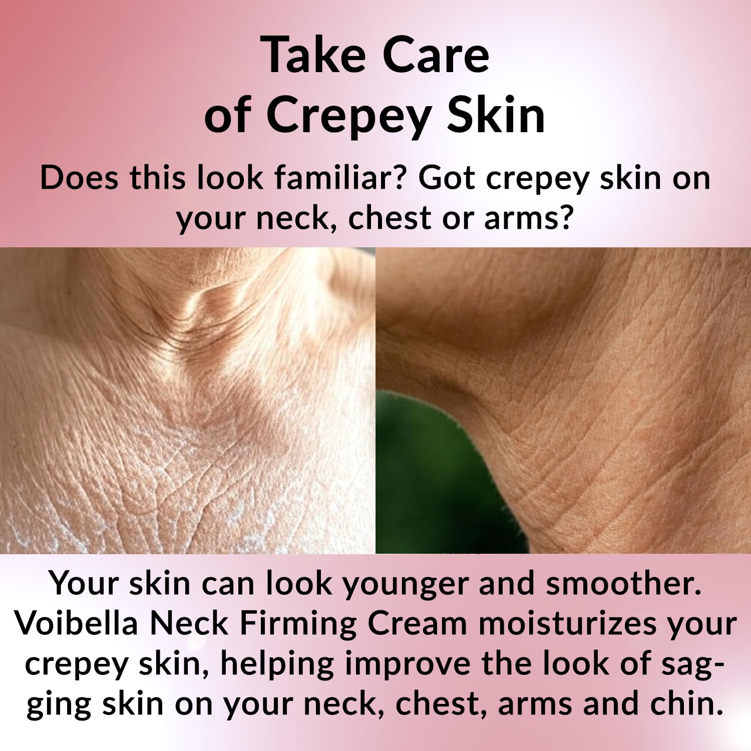VOIBELLA BEAUTY Neck Firming Cream – Tighten Crepey Skin & Décolletage