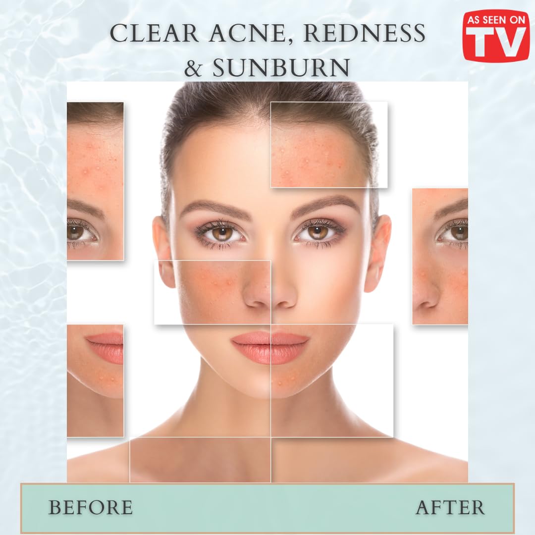 VoilaVe Pure HOCl Spray – All-in-One Skin Care & Cleaner (8 oz)