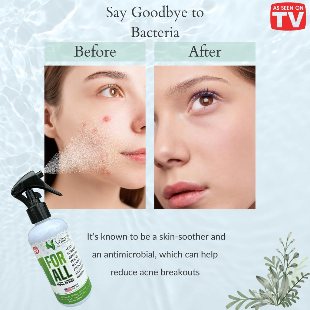 VoilaVe Pure HOCl Spray – All-in-One Skin Care & Cleaner (8 oz)