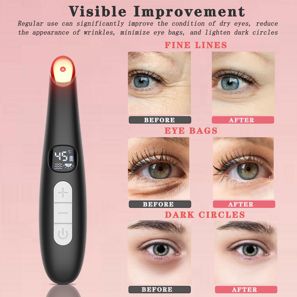 Vowleike Eye Lift Wand | 3-in-1 Eye & Face Massager with Temperature Control