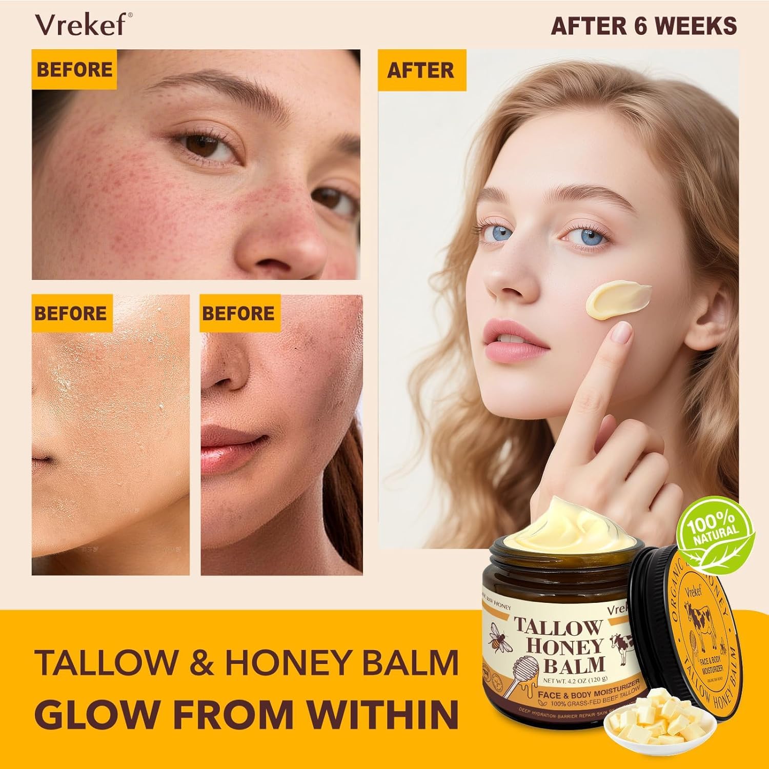 VREKEF Beef Tallow Balm for Skin – Grass-Fed Tallow, Honey, Sea Buckthorn & Shea Butter (4.2 oz)