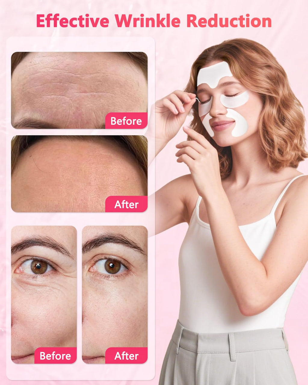 Vryioh 3-in-1 Forehead, Smile Line & Under Eye Patches – Overnight Hyaluronic Acid + Collagen