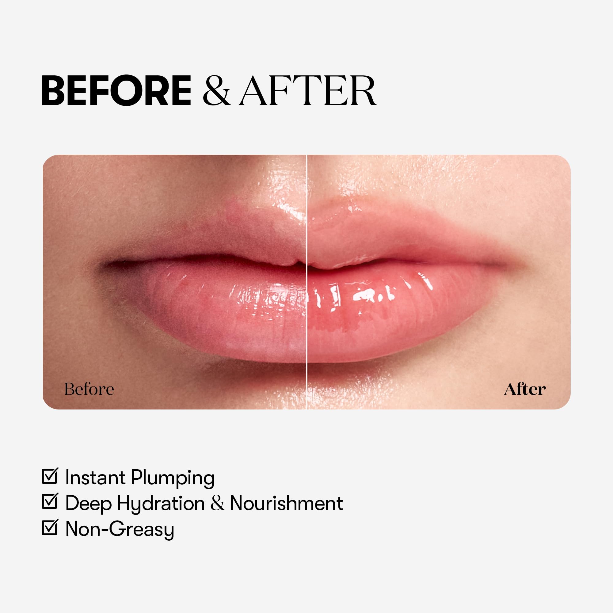 VT COSMETICS Reedle Shot Lip Plumper – Hydrating & Volumizing Clear Lip Gloss (0.15 oz) Beginner