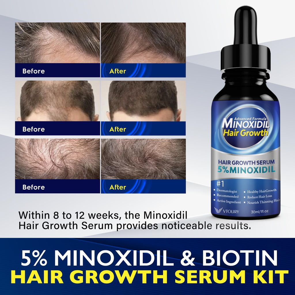 VTROUY 2-Pack Minoxidil for Men and Women — Beard Growth Oil & Hair Growth Solution