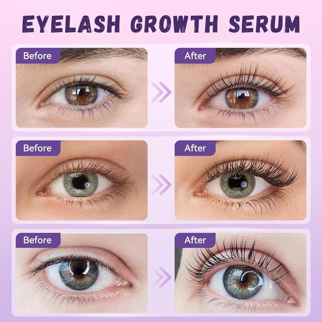 Vxzit Eyelash Growth Serum | Premium Lash Serum for Longer, Fuller Lashes (5ml)
