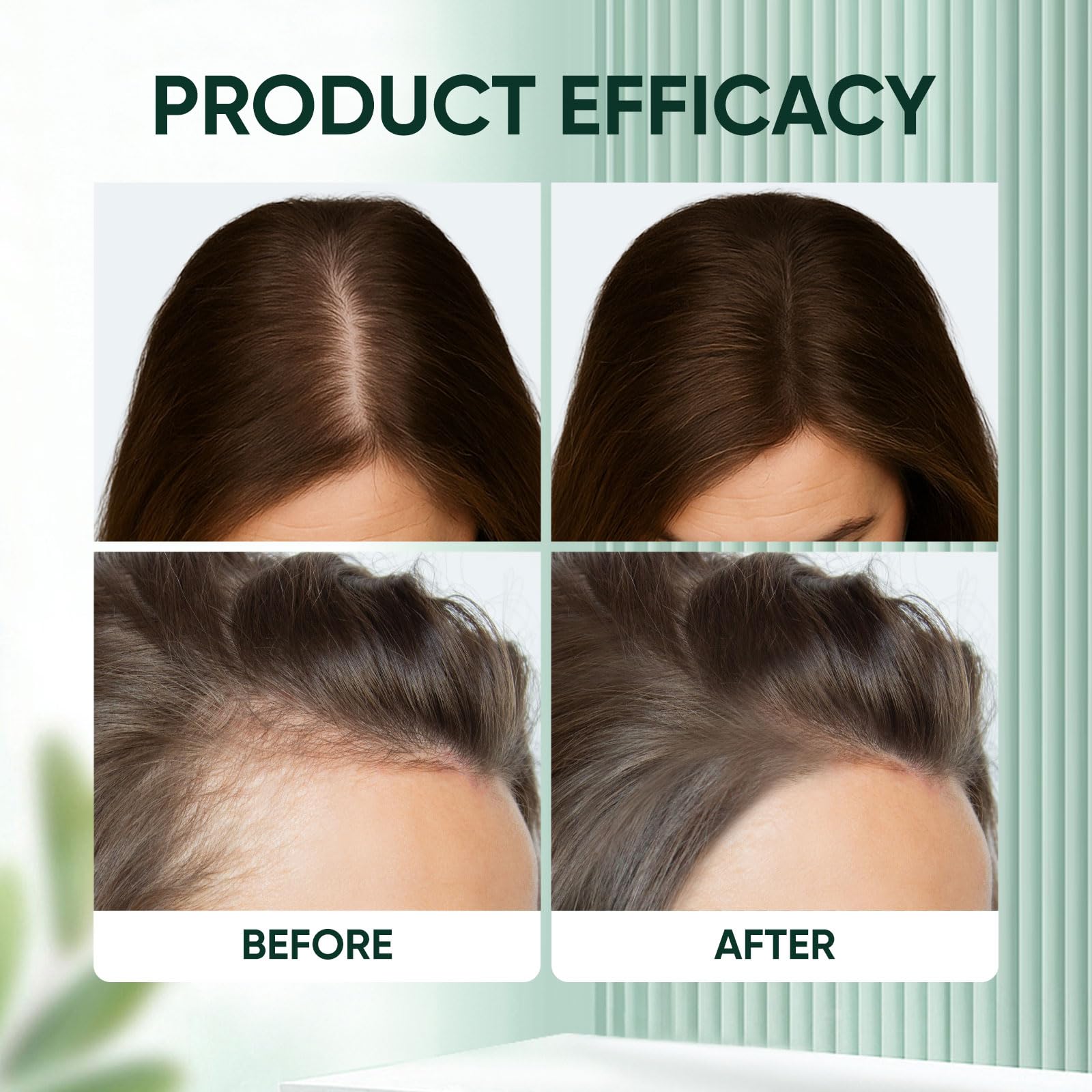 WAESKI PDRN Hair Ampoule 100dl – Vegan PDRN & Centella Scalp Treatment for Thinning Hair (2 PCS)