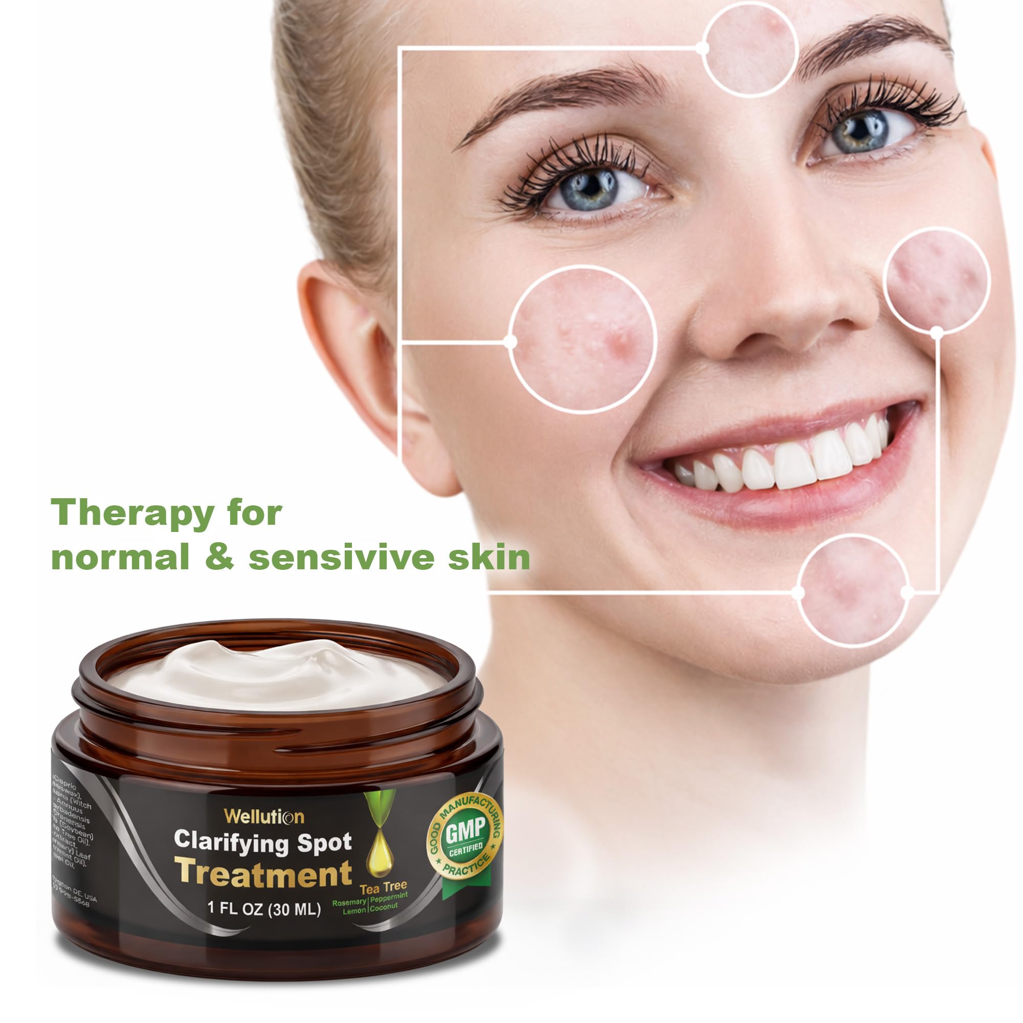 WELLUTION Cystic Acne Spot Treatment – Tea Tree Cream, Fast-Acting & Non-Greasy | 1oz
