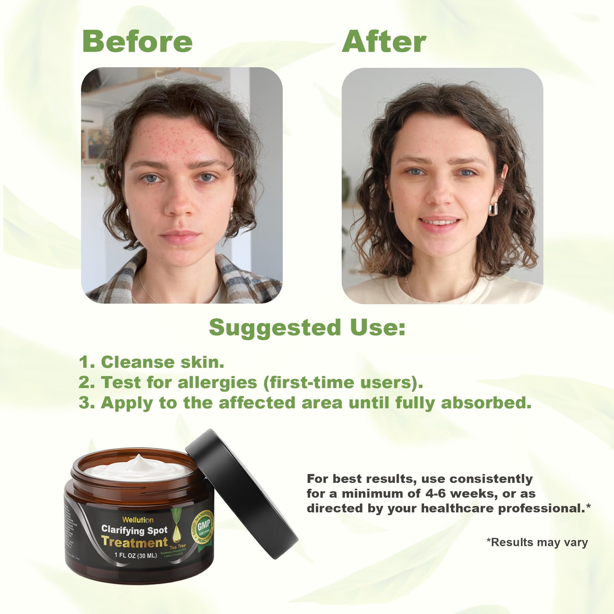 WELLUTION Cystic Acne Spot Treatment – Tea Tree Cream, Fast-Acting & Non-Greasy | 1oz