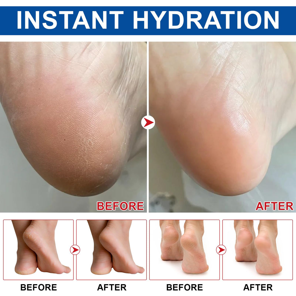Weluno 2-Pack Urea Cream Stick 60% + 2% Salicylic Acid for Dry, Cracked Heels | Maximum Strength Foot Moisturizer