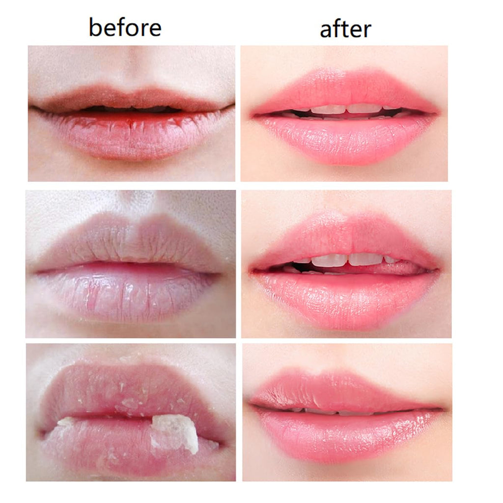 WenFeng 4-Pack Bee Lip Balm Honey Pot with Propolis – Moisturizing Lip Mask for Dry & Chapped Lips
