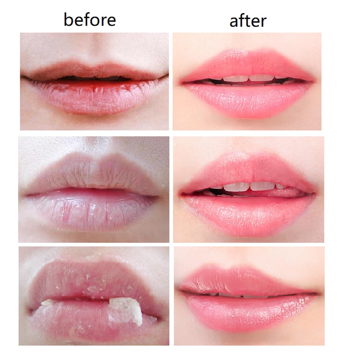 WenFeng 4-Pack Bee Lip Balm Honey Pot with Propolis – Moisturizing Lip Mask for Dry & Chapped Lips