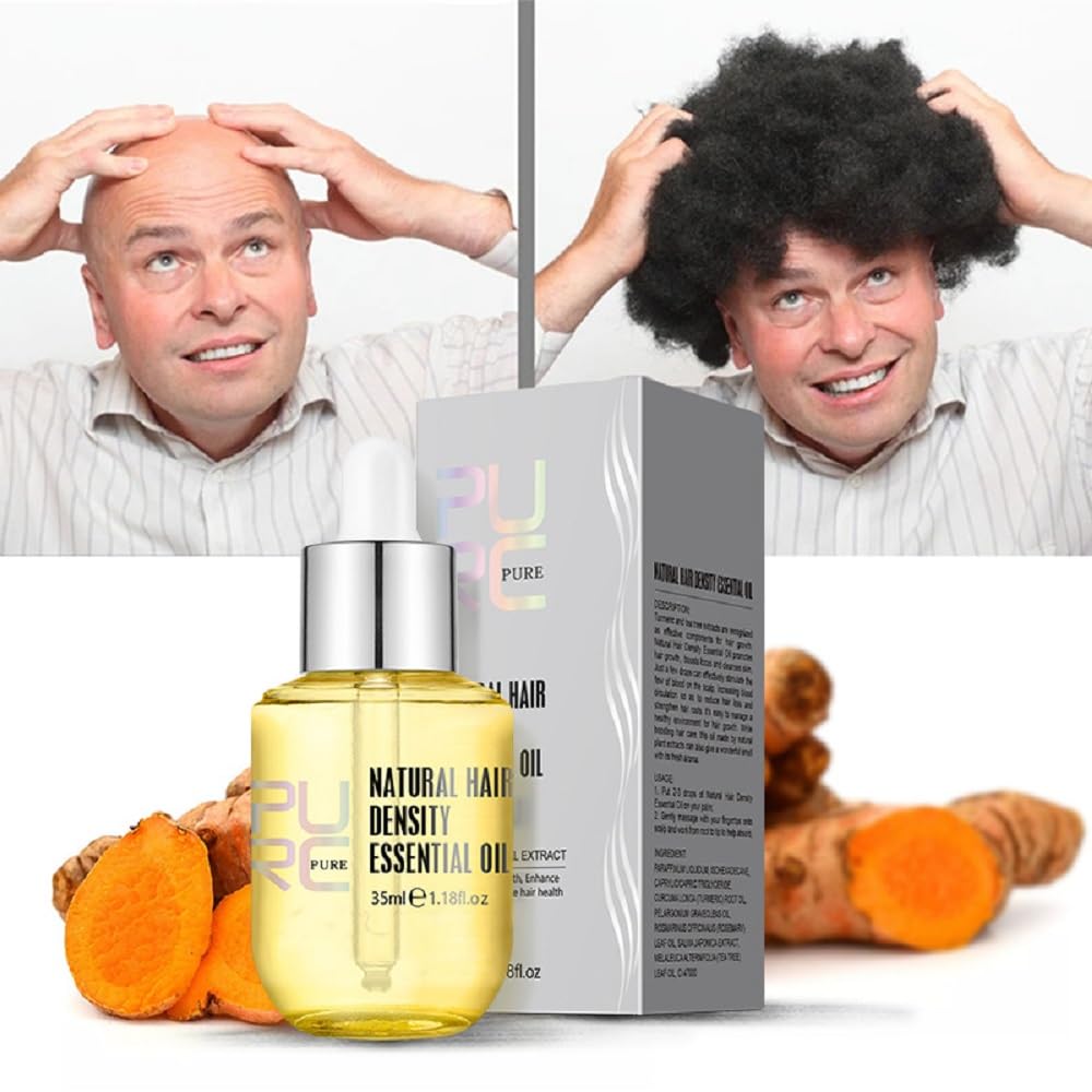 WenFeng PURC Natural Hair Density Essential Oil – Hair Regrowth Serum for Women & Men (35 ML)