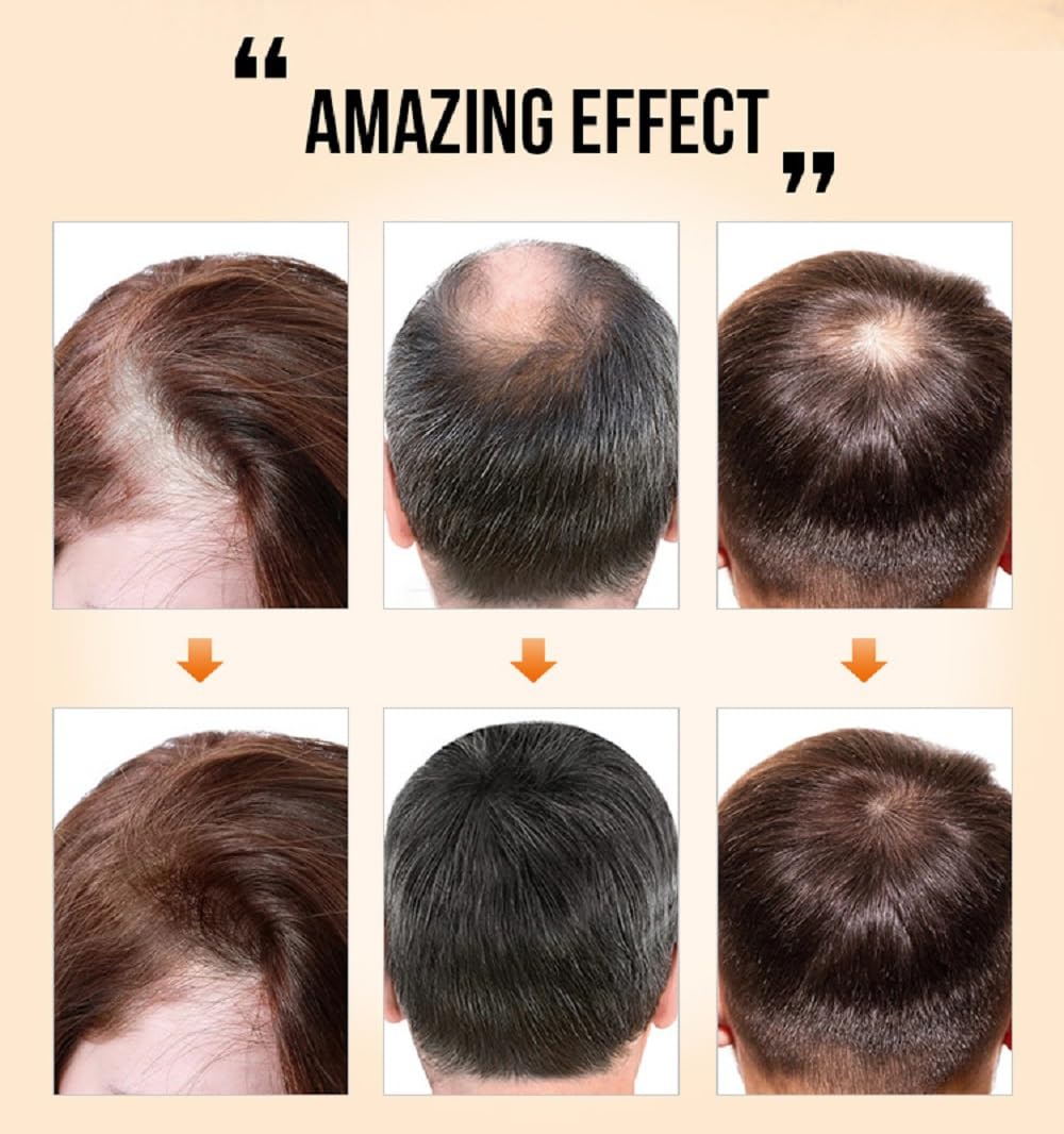 WenFeng PURC Natural Hair Density Essential Oil – Hair Regrowth Serum for Women & Men (35 ML)