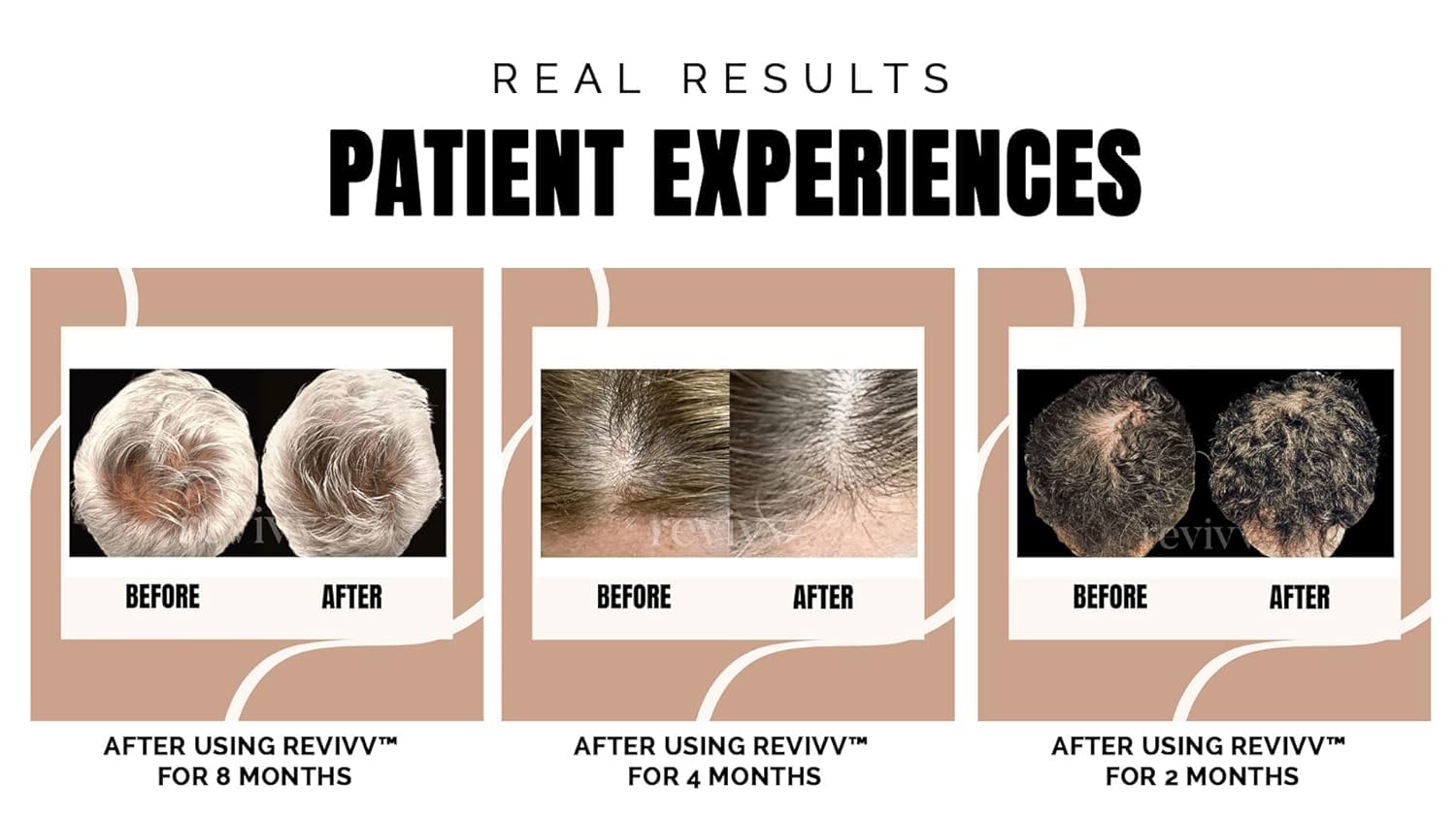 WETHRIVV REVIVV Hair Growth Serum for Men — 2-Pack, 100% Natural