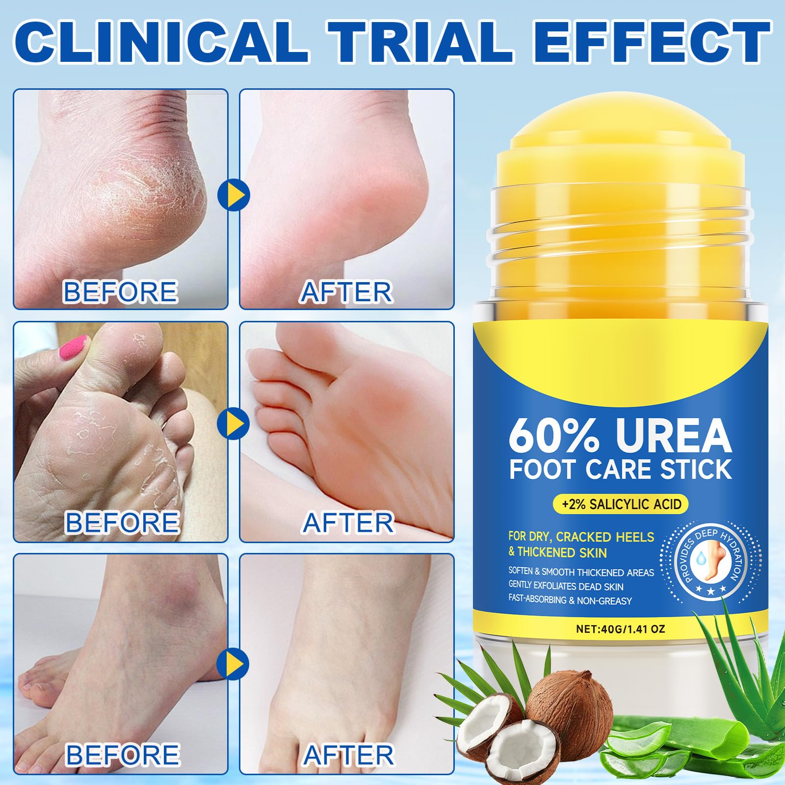 WHLH & WELL-BEING 60% Urea Foot Cream Stick with 2% Salicylic Acid – 2 Pack