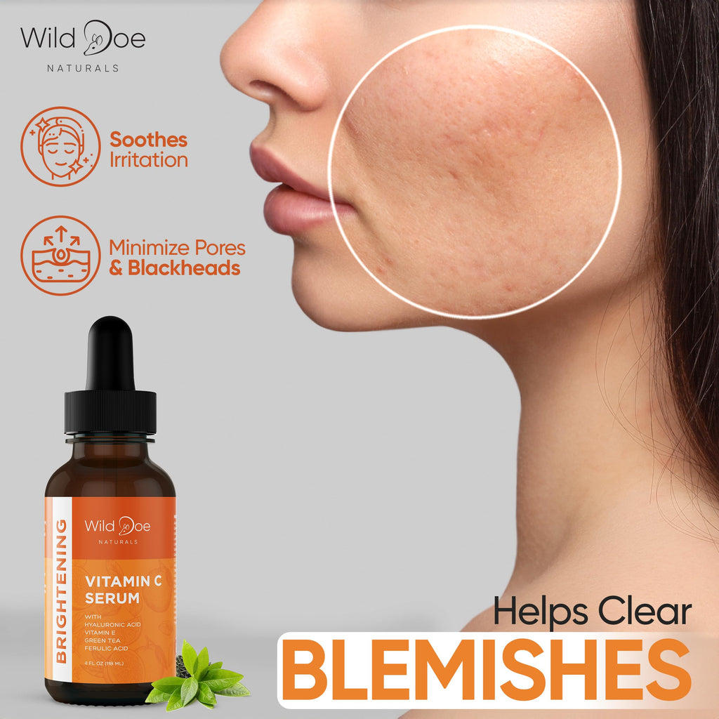 Wild Doe Naturals Vitamin C Serum with Hyaluronic Acid – Hydrating, Firming Face Serum (4 oz)