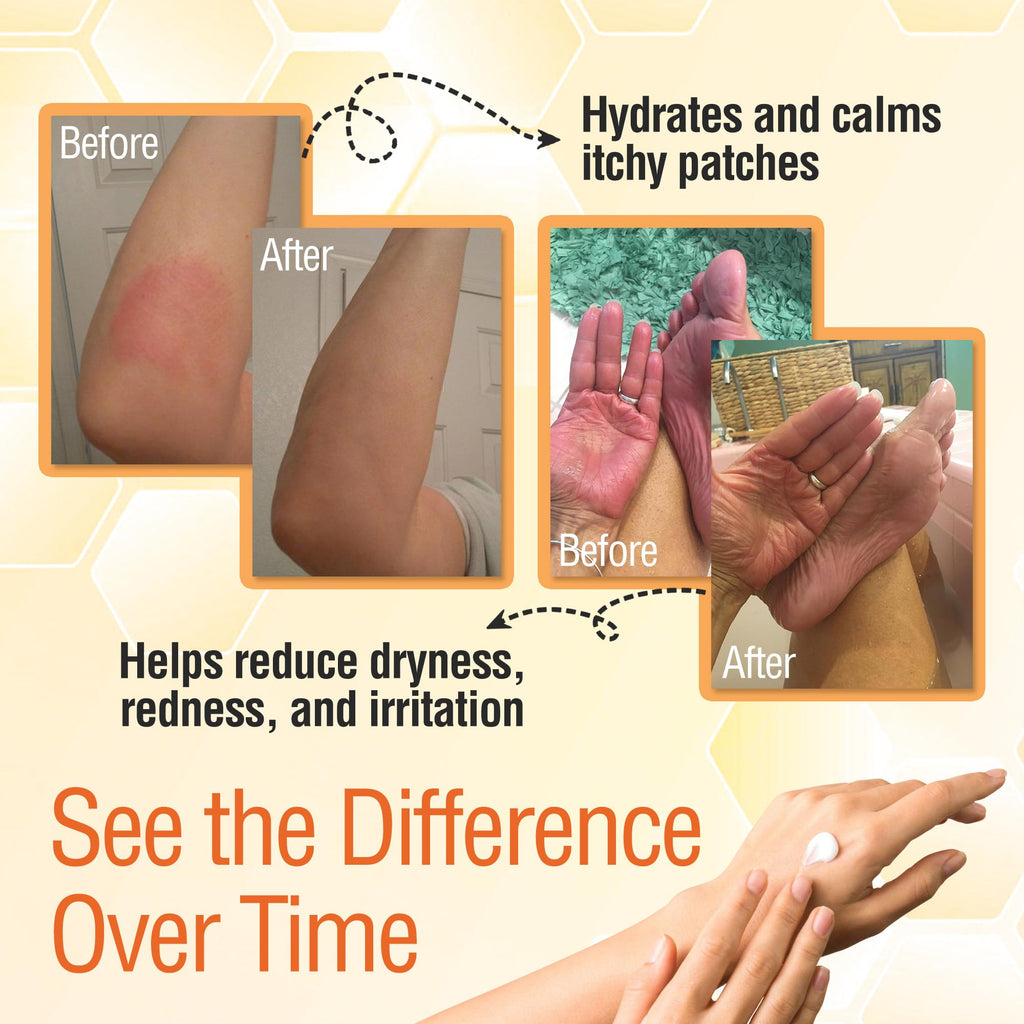 Wild Naturals Manuka Honey Moisturizer – Gentle, Non-Greasy Hydration for Dry & Sensitive Skin