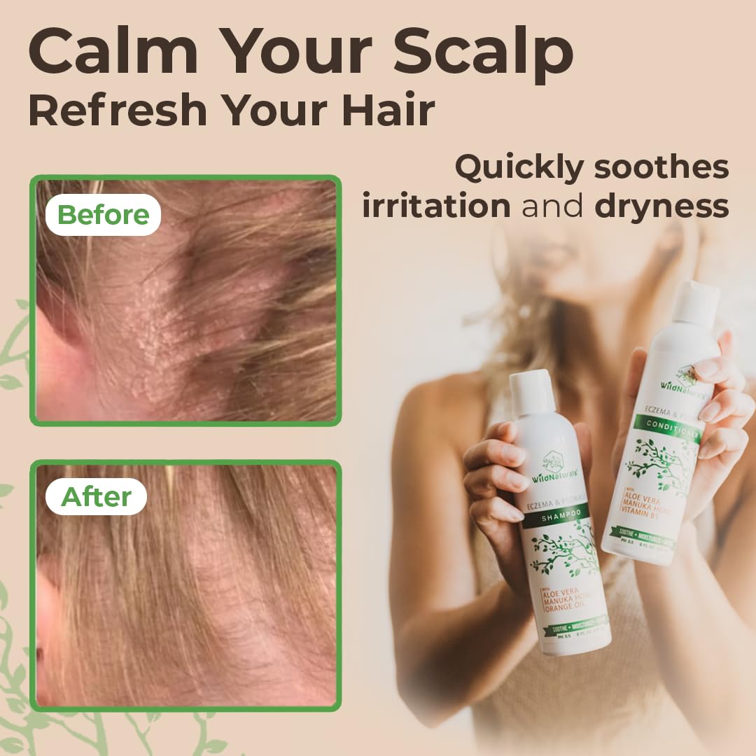 Wild Naturals Anti-Dandruff & Seborrheic Dermatitis Shampoo + Conditioner Set for Itchy Scalp