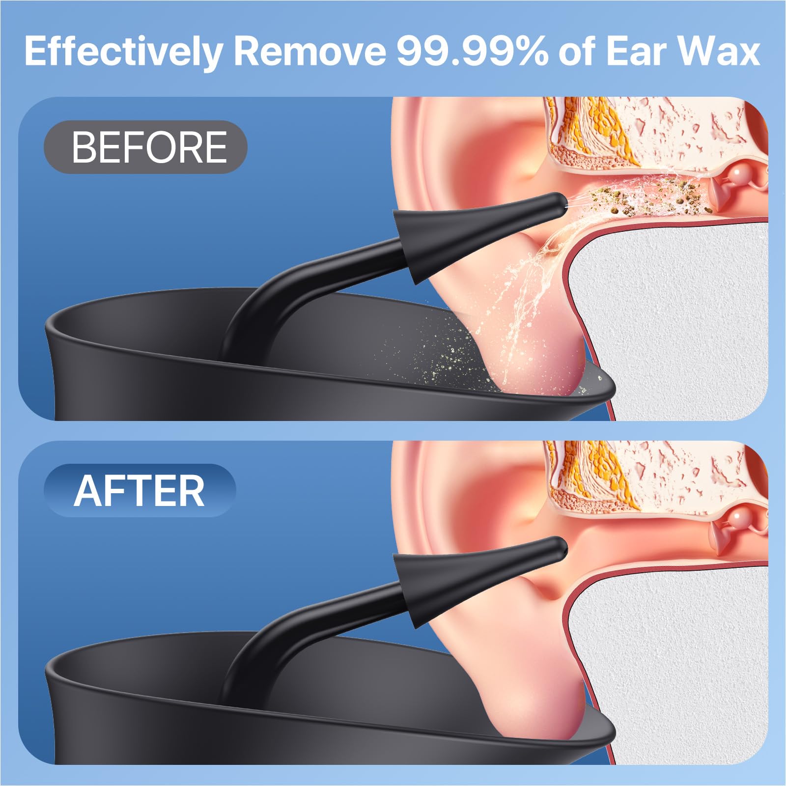 Wisdagaly Ear Cleaner – Upgraded Dual Water Tank, 4 Modes, USB-C