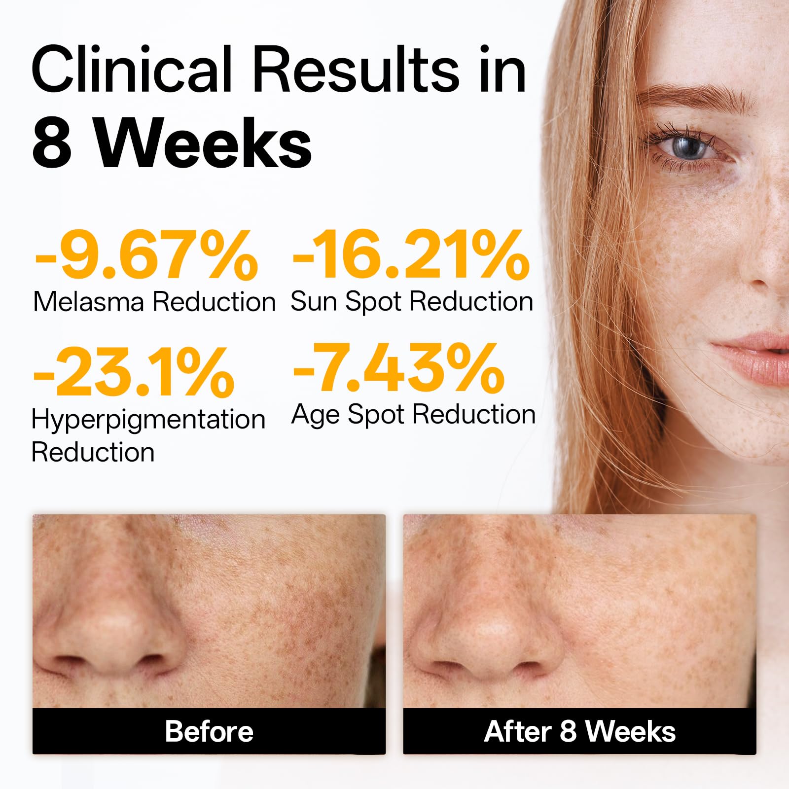 WNP Vitamin C Serum for Face – Dermatologist Tested Brightening Serum with Hyaluronic Acid & Vitamin E