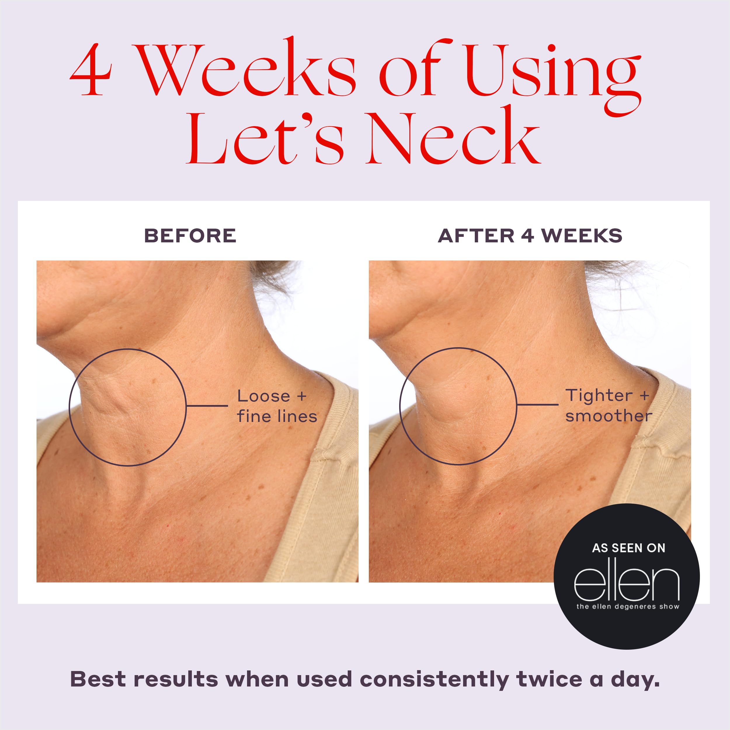 Womaness Let’s Neck Serum – Neck Tightening, Lifting & Hydration with Cooling Roller (50ml)