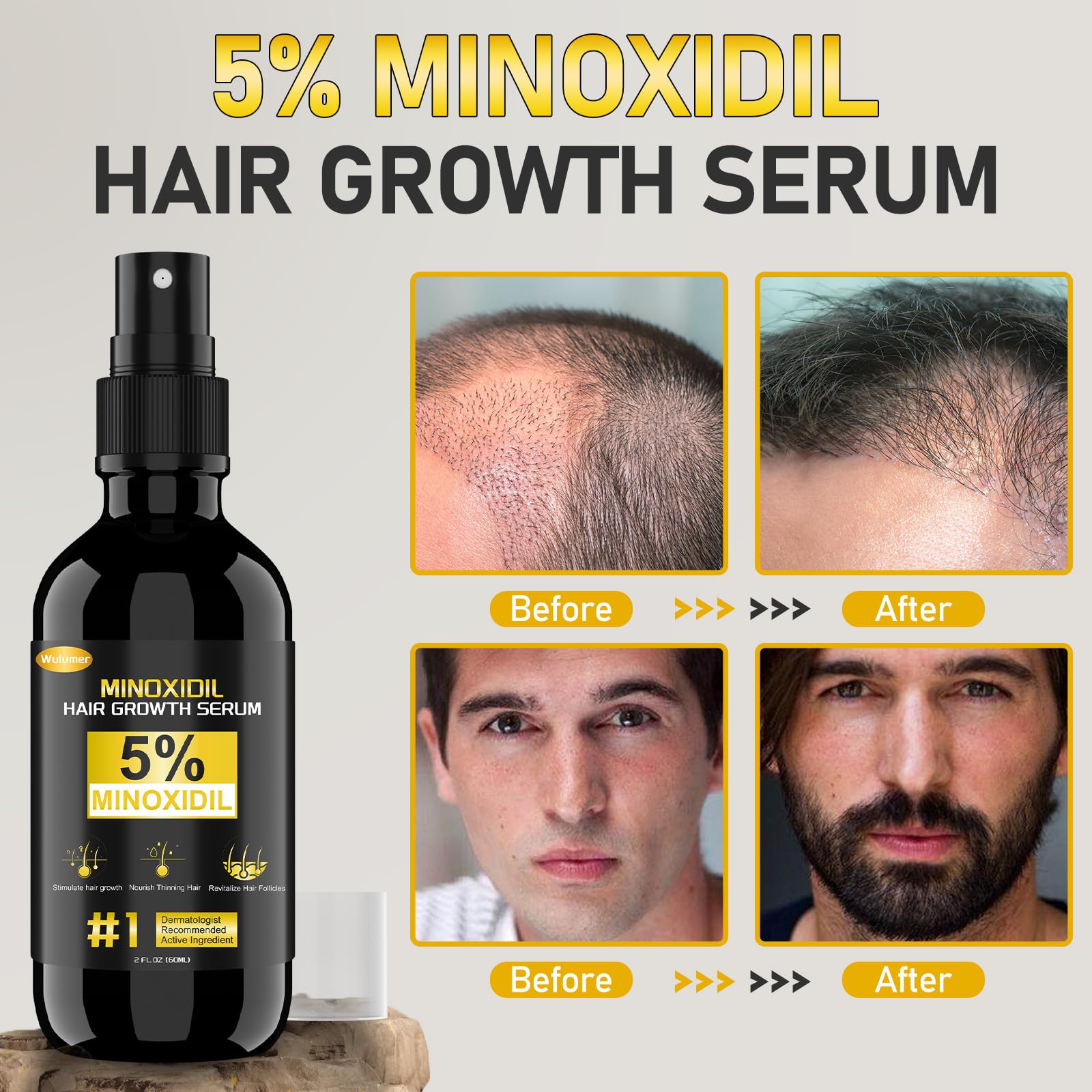 Wulumer Hair Growth Serum 5% Minoxidil for Men & Women | 2-Pack 120ml