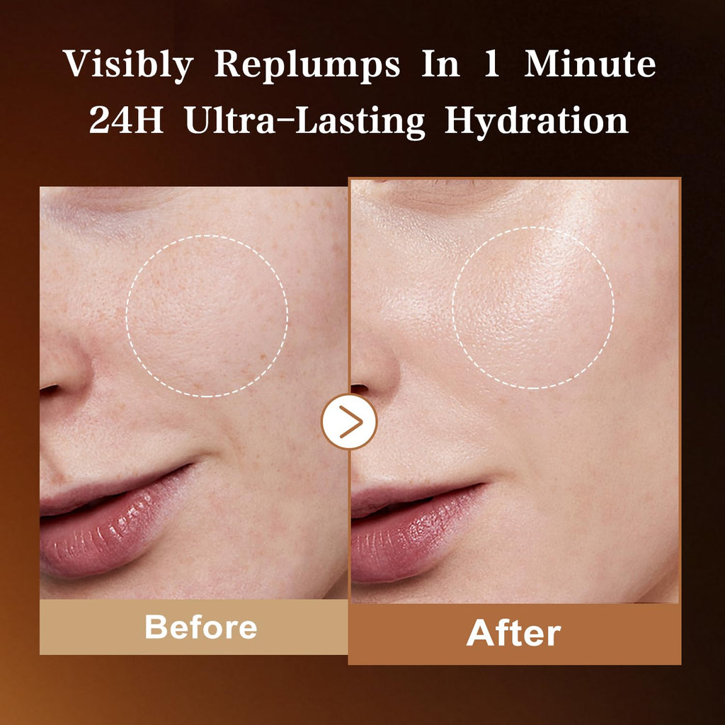 WXMX Ultra Hyaluronic Acid Serum — 8 HA Forms, Matrixyl 3000 & Collagen Tri-Complex, Multi-Layer Hydration (0.05 fl oz x 30 Ampoules)