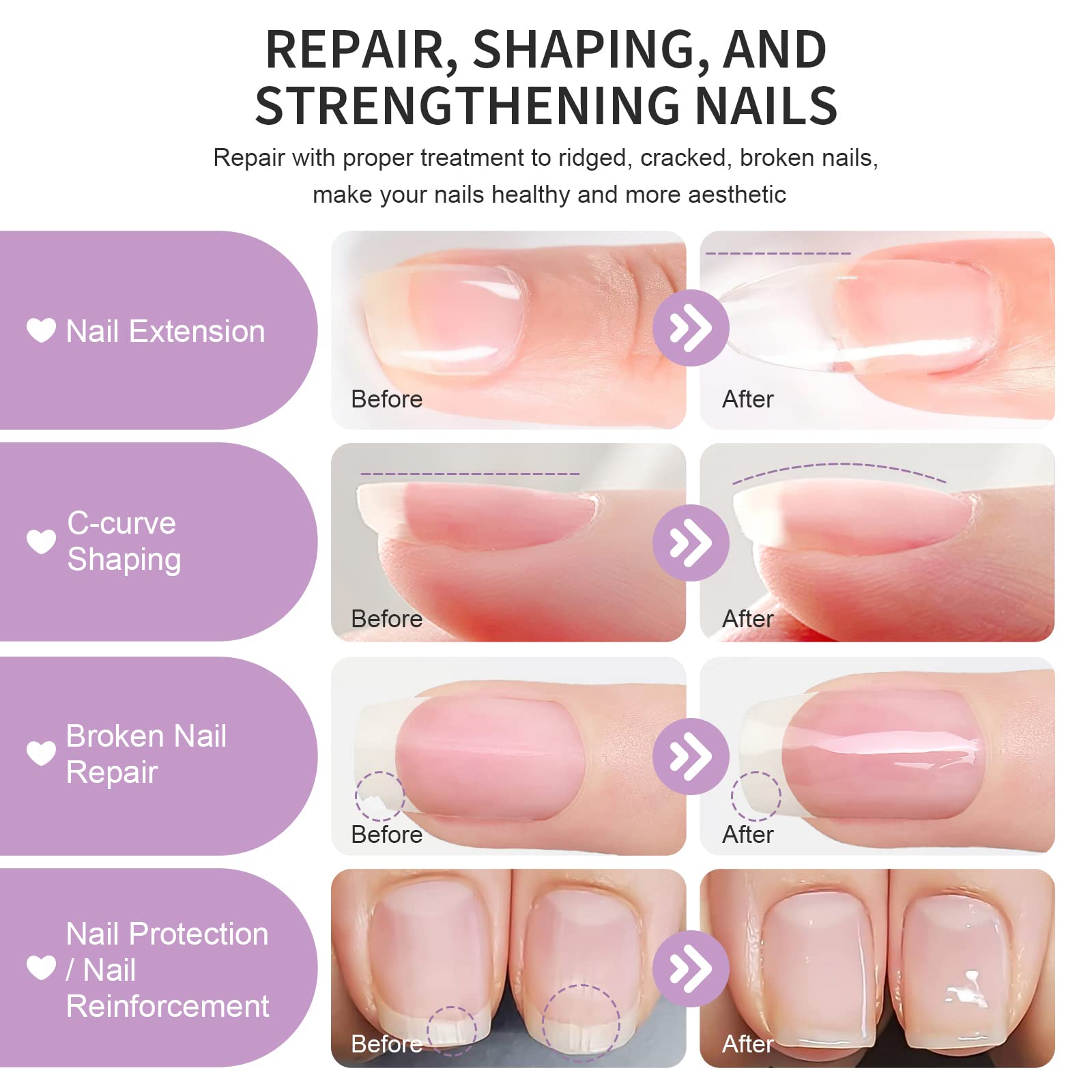 X&D Poly Gel Nail Kit: 5 Colors, Dual Forms, Brush & File Set