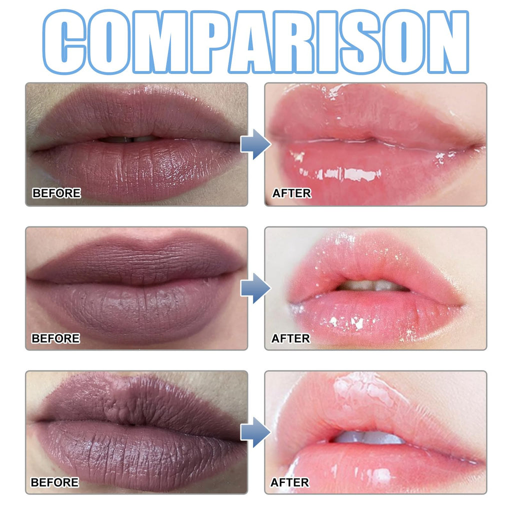 XIRUJNFD Lip Serum – Hydration & Brightening Lip Treatment