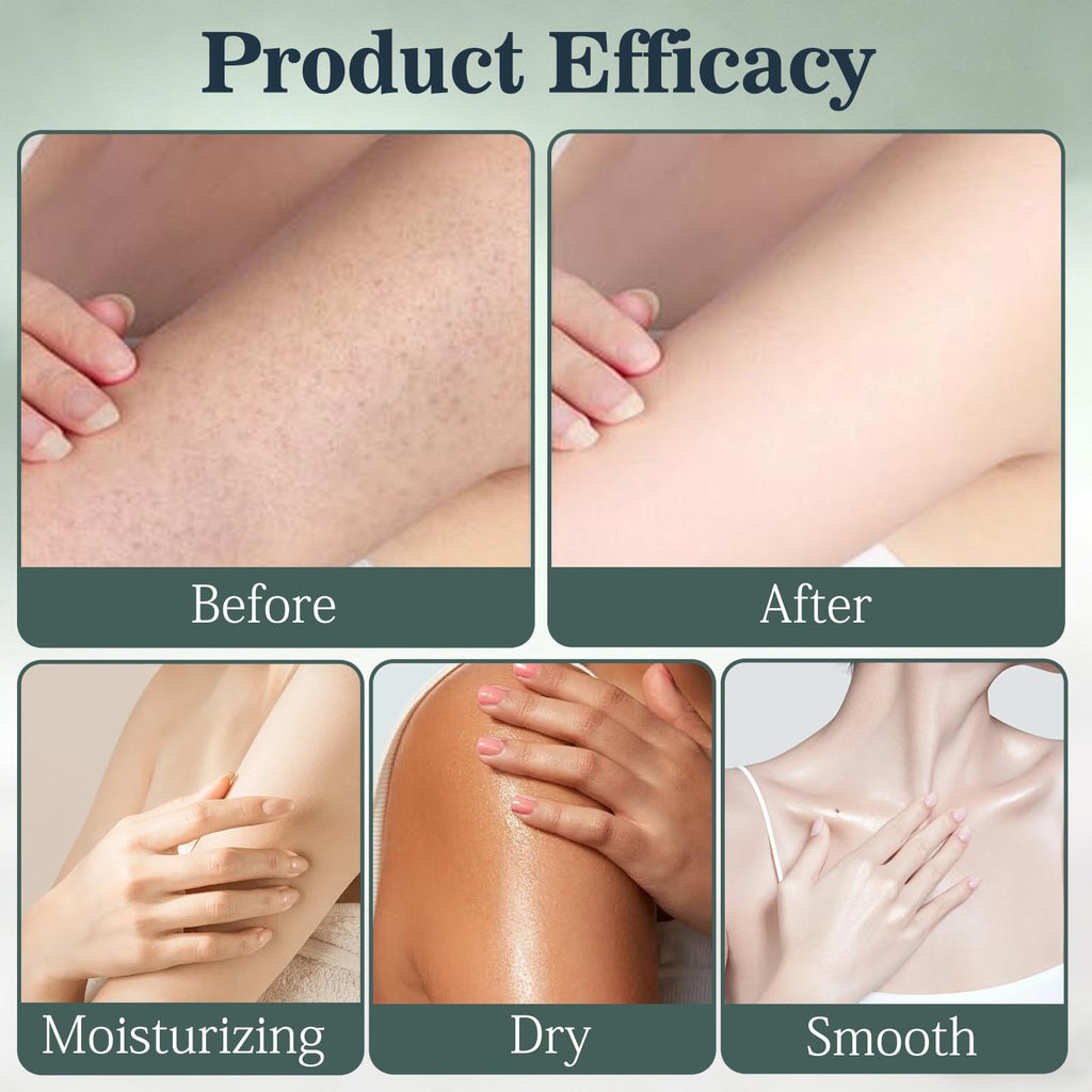 XiuFa 2PCS Intertrigo Cream – Skin Fold Care, Chafing Support, Fast-Drying Non-Greasy Formula